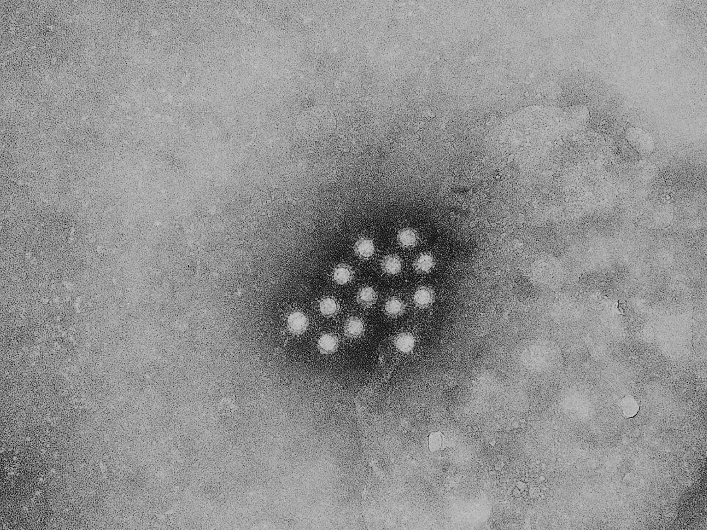 Hepatitis-A-Virus
