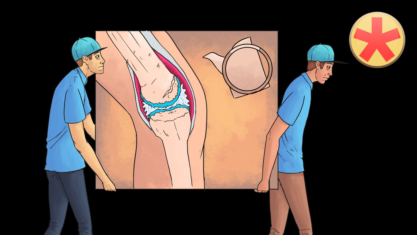 Rheumatoide Arthritis